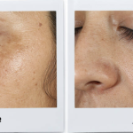 kiehls-corrective-dark-spot-corrector-reviews